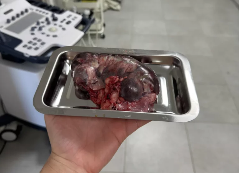 Carcinome utérin lapine